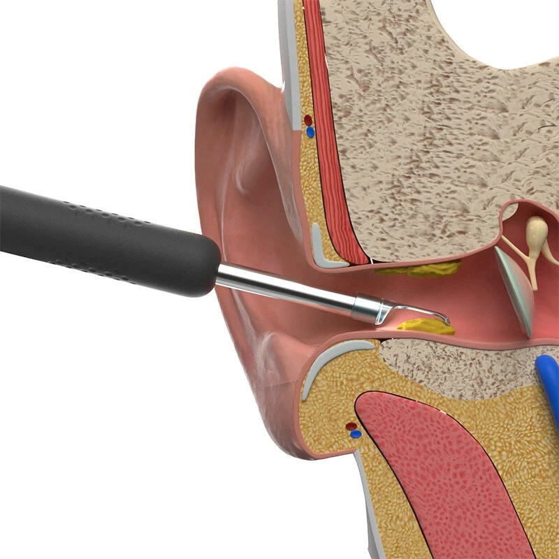 گوش پاک کن برقی ببیرد مدل Visual Ear Cleaning