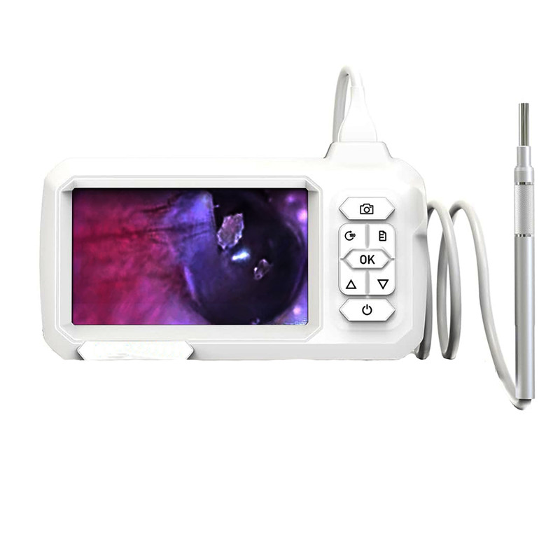 اتوسکوپ مدل مانیتور دار کد Visiual Earpick New